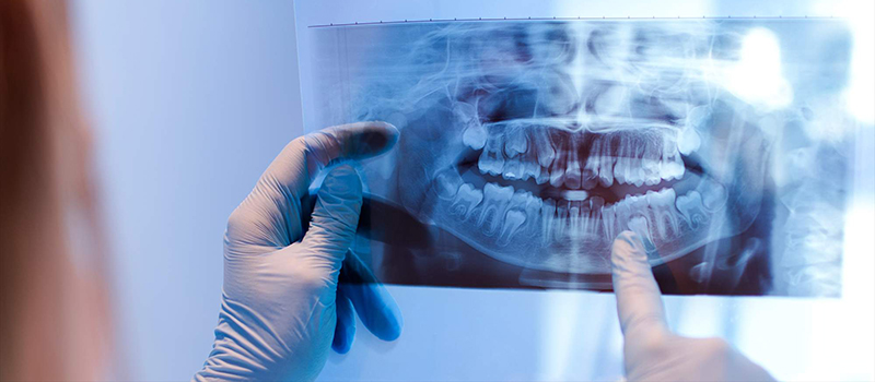 Ciruga maxilofacial | Maxilofacial Zaragoza | Dra. Mnica Lafont