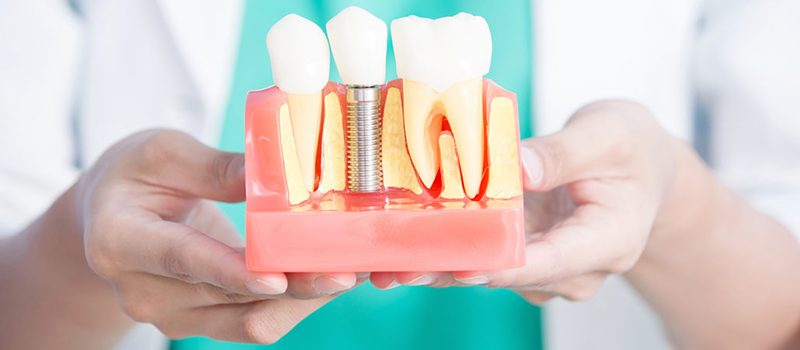 Implantologa | Maxilofacial Zaragoza | Dra. Mnica Lafont